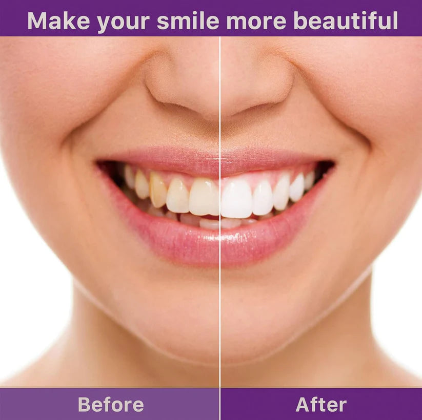 Clinclii™ V36 Whitening Strips – Professional Teeth Whitening at Home
